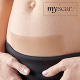 Myscar Premium Silicone Strips